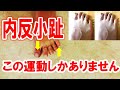 内反小趾の原因と自分でできるセルフケア