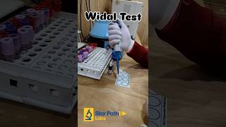 Typhoid Test Kaise Kiya Jata hai❔#shorts Widal Test 🤕 कैसे होता है #viralshorts #labtechnician