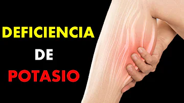 ¿Se puede sufrir un ictus por un nivel bajo de potasio?