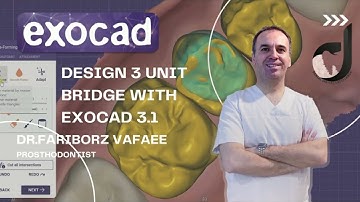 how to design 3 unit bridge with exocad3.1(part2)