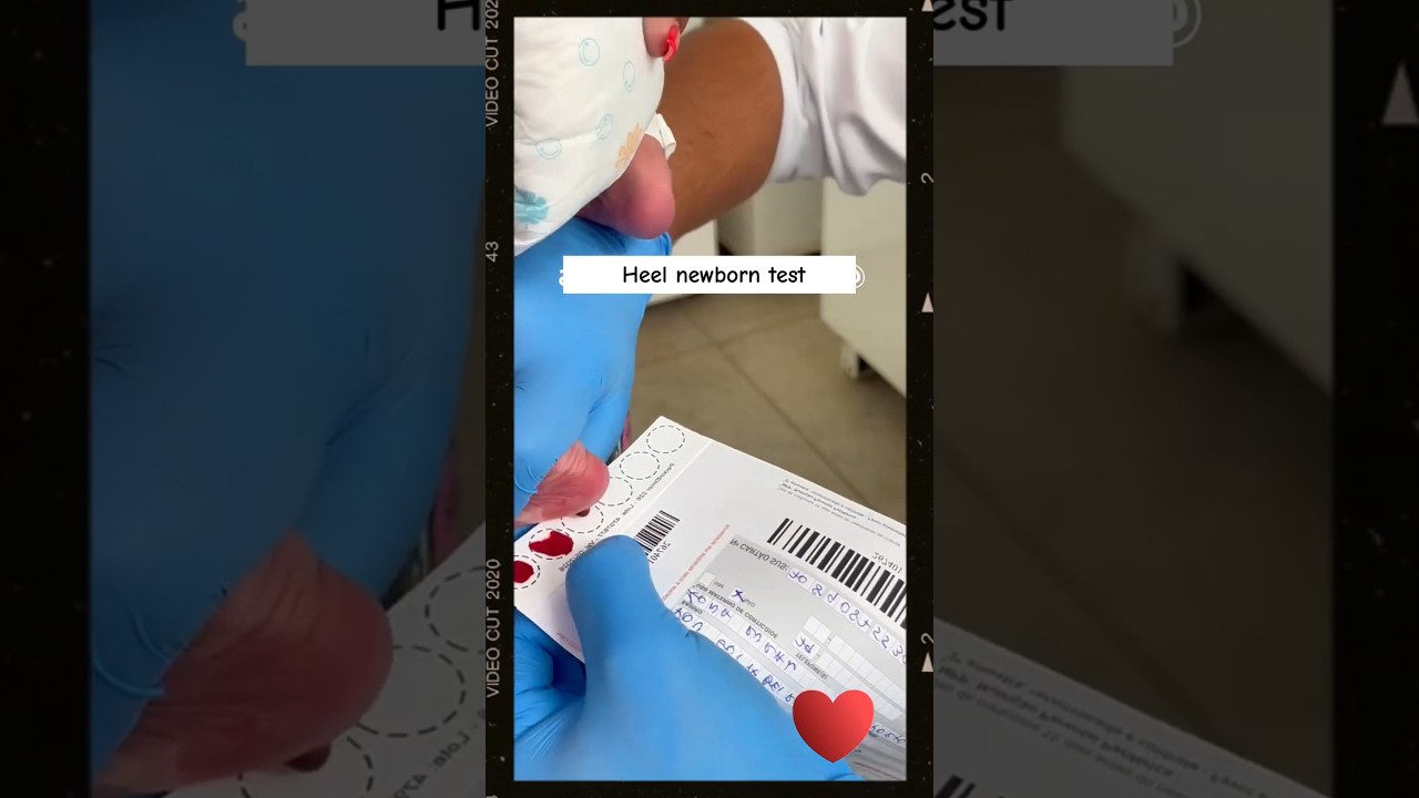 Newborn’s First Blood Test – So Tiny! 🍼 💉