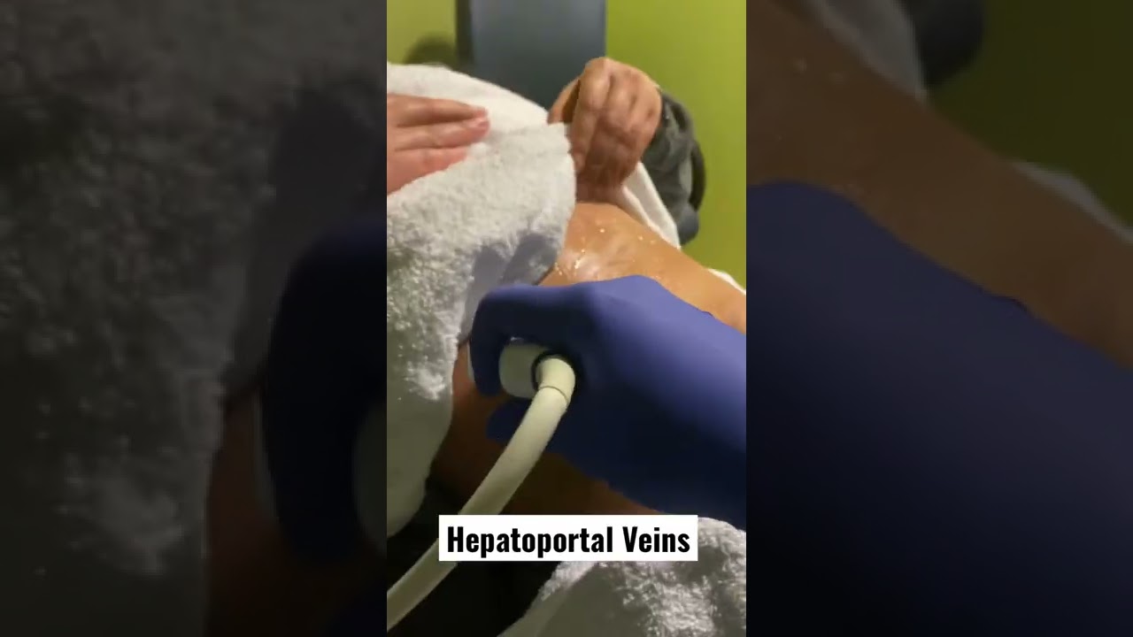 Печеночные и воротные вены