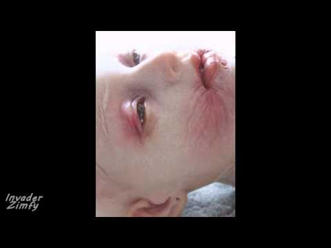 SCP 195 Медицинский виски