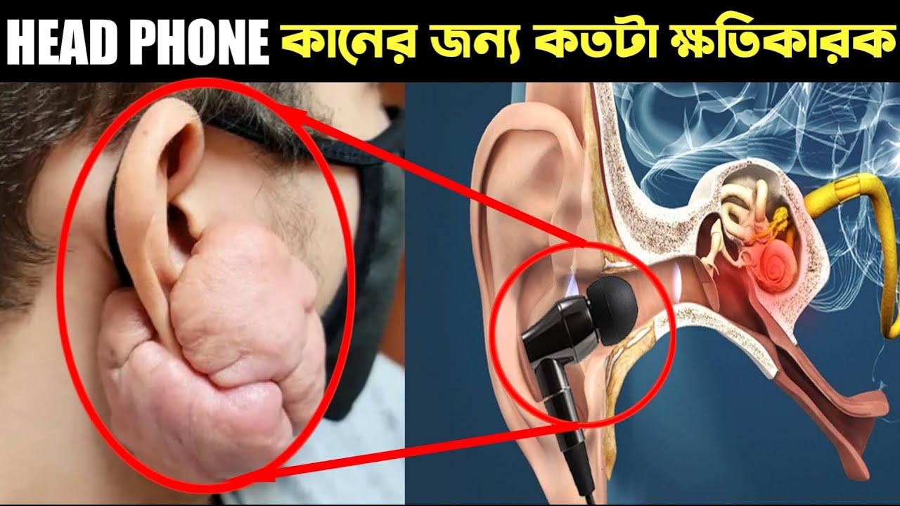 Headphone কিভাবে আমাদের কানের ক্ষতি করে How Earbuds Damage Our Ears
