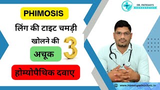 Phimosis          phimosis 