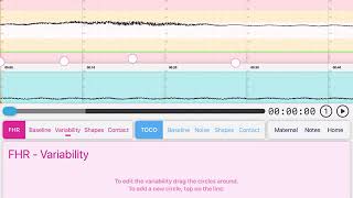 CTGi Facilitator Variability editing