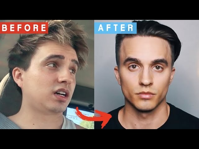 How ANYBODY Can Get a Chiseled Face & Strong Jawline (THE ONLY WAY TO LOSE  FACE FAT!) 