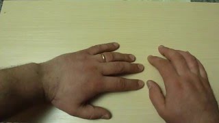 Как снять кольцо с опухшего пальца Как снять кольцо с опухшего пальца
