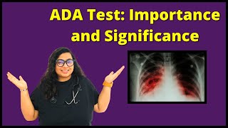 Adenosine Deaminase Test | Procedure, Precautions, Reasons Explained