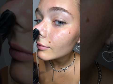 ВЕСНУШКИ-ЗЛО👿 | избавляемся от пигментации? Рассказать подробнее? #косметолог #лицо #sos