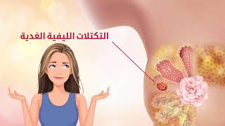 عيادة أ.د/ عمر فاروق - تكتلات وأورام الثدي الحميدة