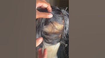 BALDING LACE FRONTAL? REPLACE THE Frontal on my Wig ft HD FRONTAL #wigtutorial #amazonwigs