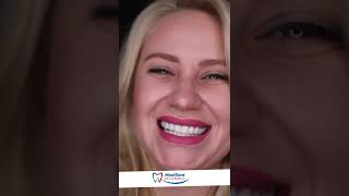 Çok Memnun Kaldım, Herkese Tavsiye Ederim