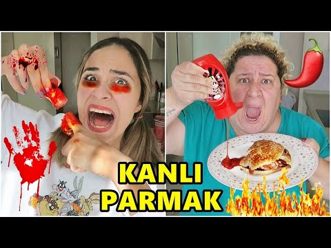 24 SAAT BOYUNCA ANNEME TİKTOK ŞAKALARINI YAPTIM !! (KANLI PARMAK)