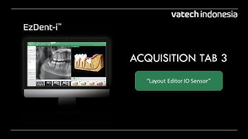 EzDent-i "Acquisition Tab 3: Layout Editor IO Sensor"