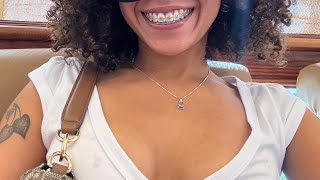 Vlogcome Wme To Get My Braces Off