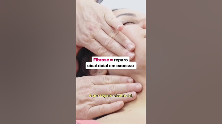 Faça essa prática em fibrose se você quer ser referência em pós-operatório