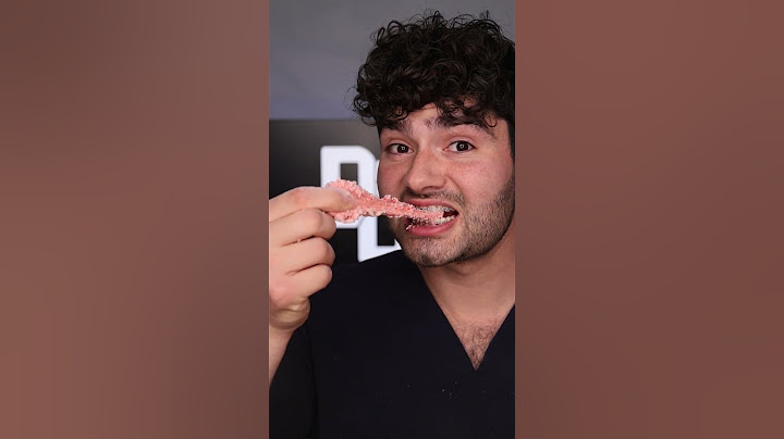 Ice Cream vs Braces !?