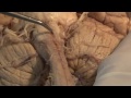 The Most Important Pathway: Motor Control: Neuroanatomy Video Lab - Brain Dissections