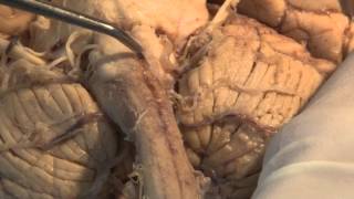 Download lagu The Most Important Pathway Motor Control Neuroanatomy Video Lab Brain Dissections The Most Important Pathway Motor Control Neuroanatomy Video Lab Brain Dissections
