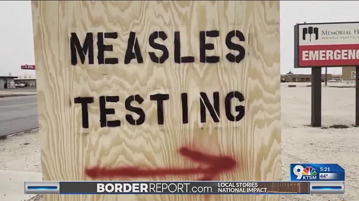 90 confirmed cases of measles across West Texas