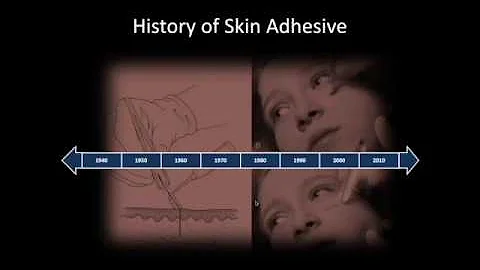 Webinar – Protecting Your Patient and Vascular Access Devices from "Sticky Situations"