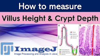 Measurement of villus height and crypt depth with ImageJ | Morphometry of intestine screenshot 1