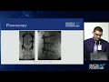 Thoracolumbar Fractures: A Case Presentation and Overview of AO Spine Classification - Sye Jabbouri