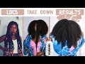 TAKING OUT MY LOCS AND THIS IS WHAT HAPPEND! |SHOCKING RESULTS! ft. MELANIN HAIRCARE| Obaa Yaa Jones