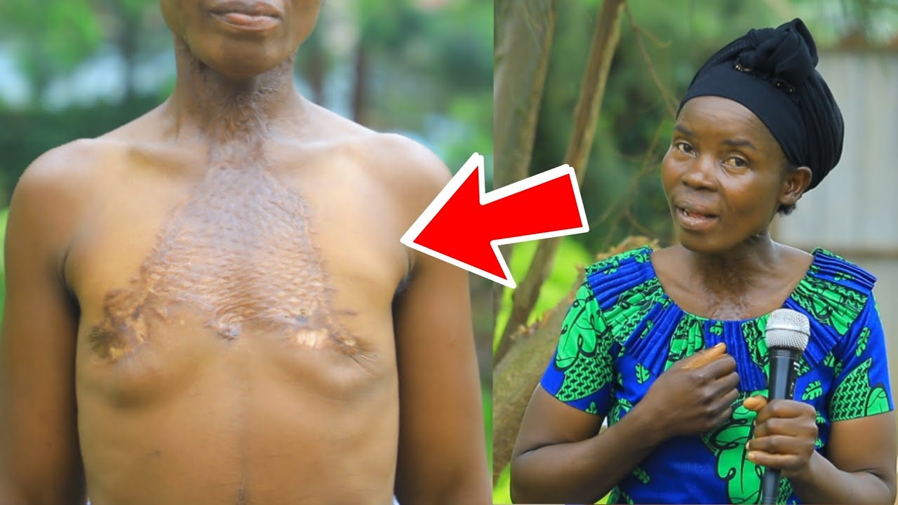 CYANGUGU: Tugeze kuri MUZUKA, Umugore baciye Amabere yose Akabaho | UBU NI UBUHAMYA BUFITE IBIHAMYA