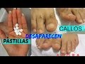 Callos que desaparecen tratamiento casero/Remove callus from feet at home