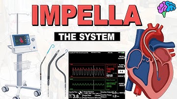 Impella Basics: How the Catheter, AIC, and Purge System Work Together
