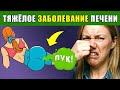 17 ПРИЗНАКОВ того, что ваша ПЕЧЕНЬ УМИРАЕТ   ОПАСНО!