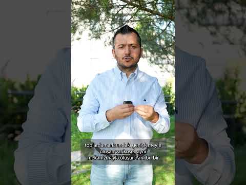 Erkeklerin Pelvik Venöz Hastalığı: VARİKOSEL. #varikosel #erkeksağlığı #infertilite