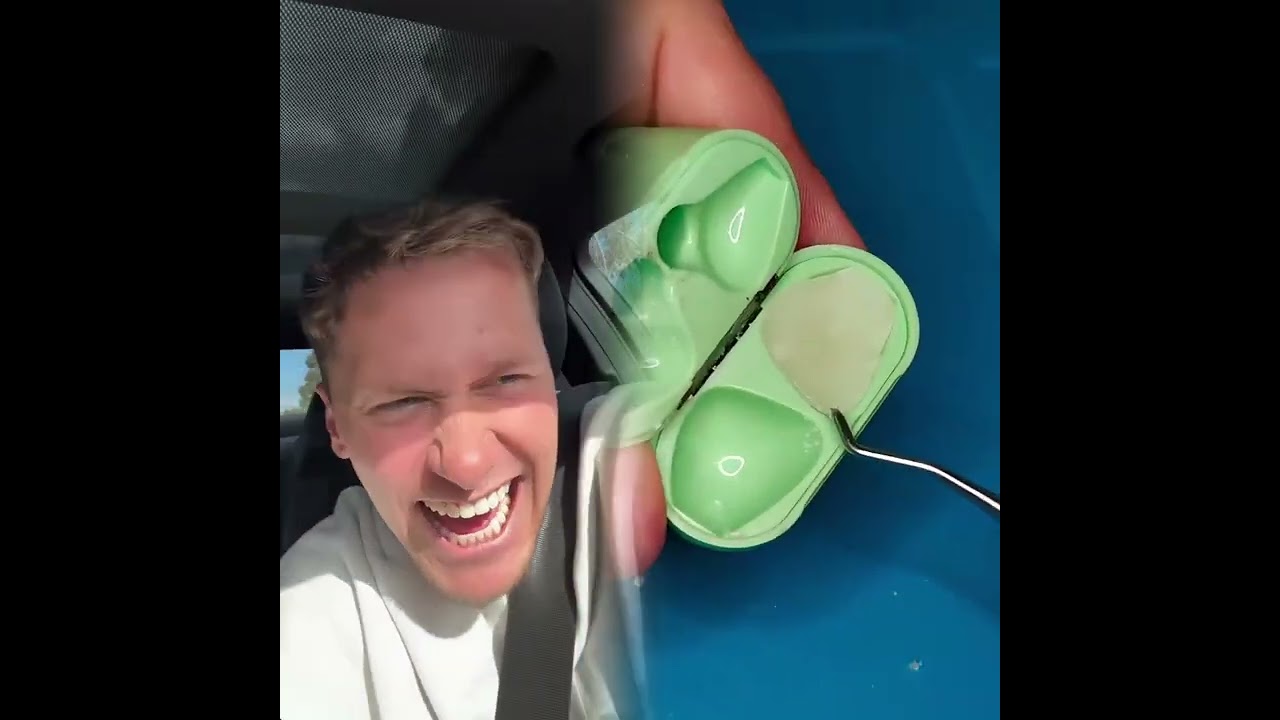 🤣👌👌👌2026 pov Must-Watch Crazy Clips Compilation #humor #fypシ #pov #fyp #foryou 😍😜