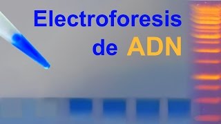 Electroforesis de ADN en gel de agarosa (IQOG-CSIC)