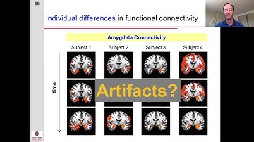 Resting state functional connectivity: Part 3 - Potential Artifacts