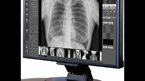 Tweak and Send! QA and QC for Digital Radiographers -