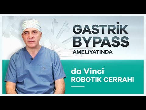 Gastrik Bypass Ameliyatında ''da Vinci Robotik Cerrahi'' Yöntemi - Prof. Dr. Abdülkadir Bedirli