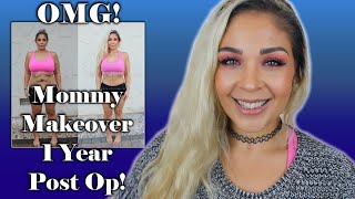 Mommy Makeover 1 Year Update!! AgapeLoveGirl EPS Miami Team Elite