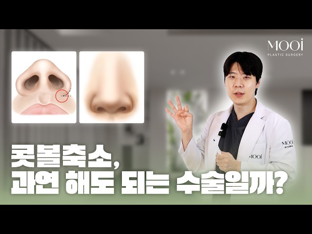 콧볼축소, 과연 해도 되는 수술일까?｜무이성형외과 #콧볼축소#코성형