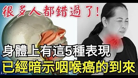 身體上有這5種表現，已經暗示咽喉癌的到來！很多人都錯過了 - 天天要聞