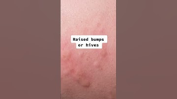 Signs You