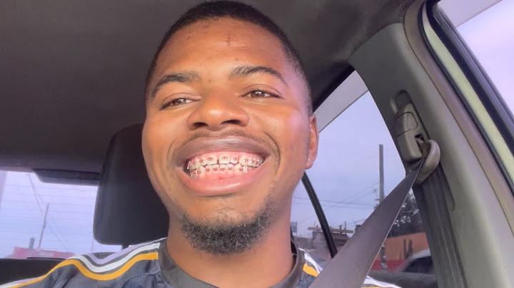 I SPENT ALL MY MONEY ON BRACES IN JAMAICA (FULL BREAKDOWN)