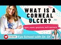 What Is A Corneal Ulcer? | Types, Causes, Symptoms, and Treatments