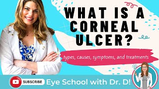 What Is A Corneal Ulcer? | Types, Causes, Symptoms, and Treatments