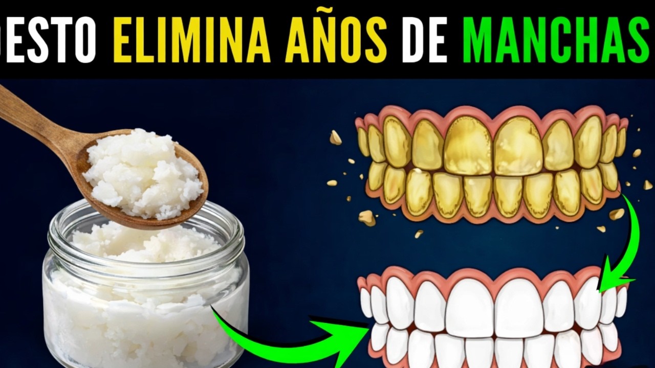 Cómo Eliminar Años de Dientes Amarillos Naturalmente