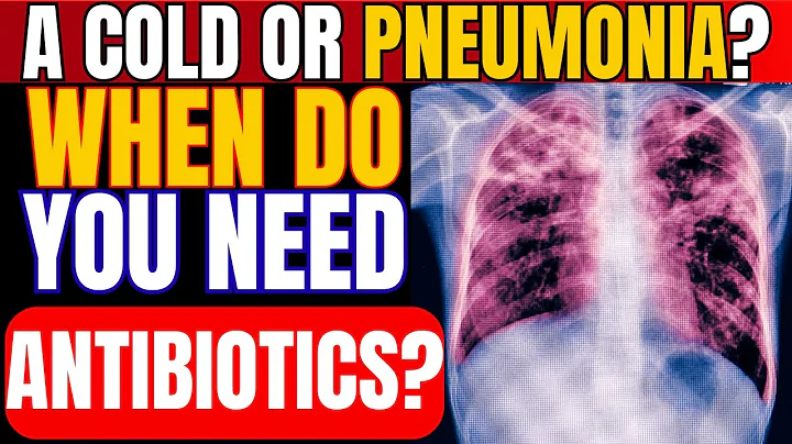 Pneumonia: What ACTUALLY Is It AND When Do You Need ANTIBIOTICS? | Doctor Explains
