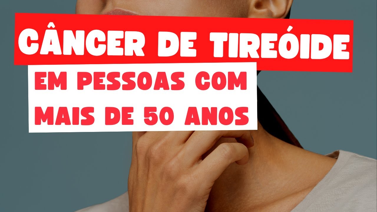 Câncer de tireoide é mais agressivo em pessoas com mais de 50 anos