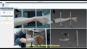 Whole process of AFO design with MediACE3D